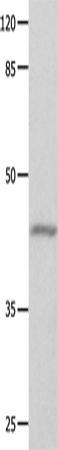 Rabbit Polyclonal Antibody to GNA11
