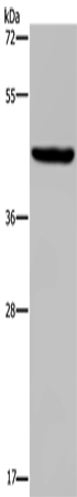 Rabbit Polyclonal Antibody to GNAS