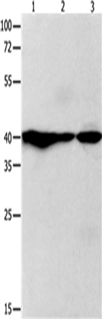 Rabbit Polyclonal Antibody to GNAZ