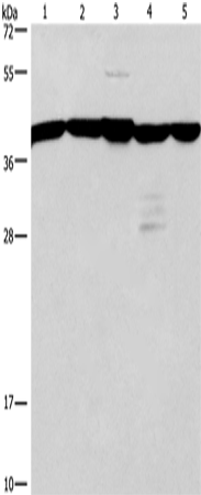 Rabbit Polyclonal Antibody to GNA13