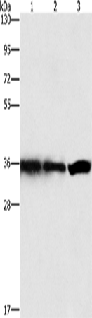 Rabbit Polyclonal Antibody to GNB1