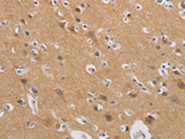 Rabbit Polyclonal Antibody to GNB5