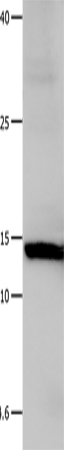 Rabbit Polyclonal Antibody to LGALS1