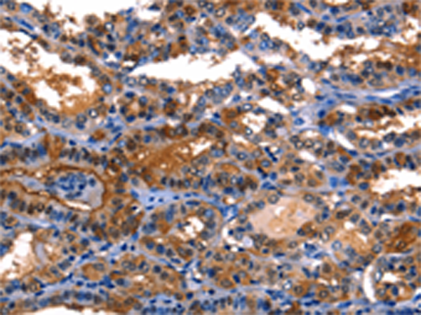 Rabbit Polyclonal Antibody to LGALS8