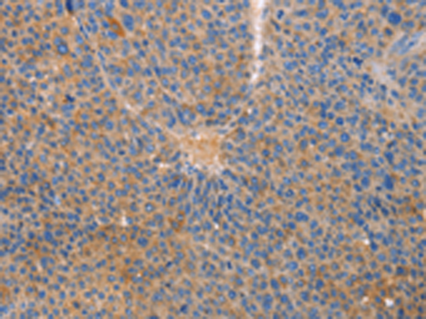 Rabbit Polyclonal Antibody to CXCL3