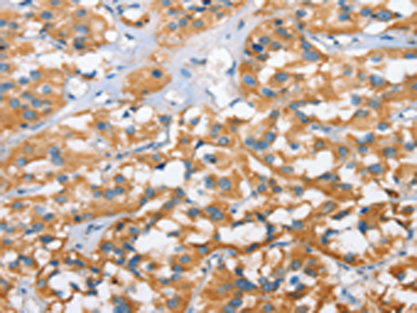 Rabbit Polyclonal Antibody to CXCL14