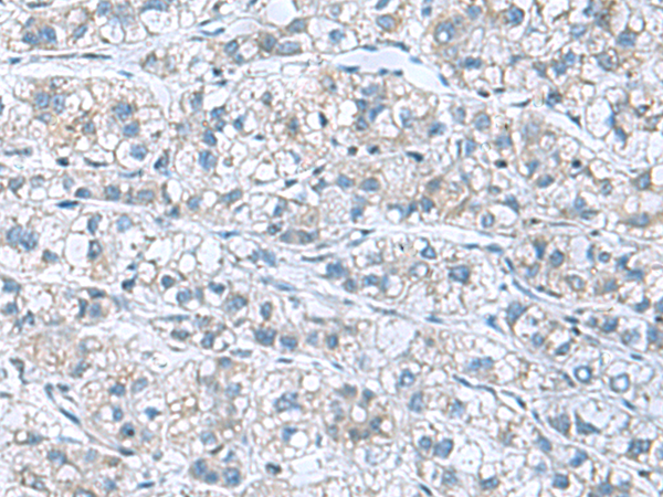Rabbit Polyclonal Antibody to GDF9