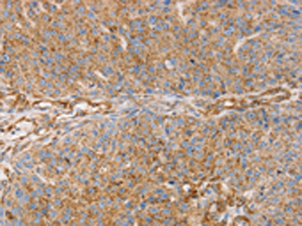 Rabbit Polyclonal Antibody to GFAP