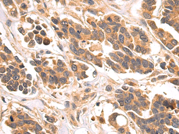 Rabbit Polyclonal Antibody to GIP