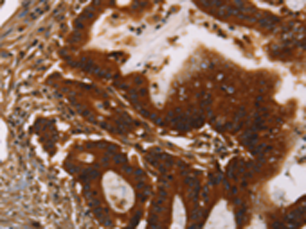 Rabbit Polyclonal Antibody to GPA33