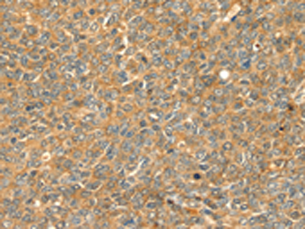 Rabbit Polyclonal Antibody to GRB2