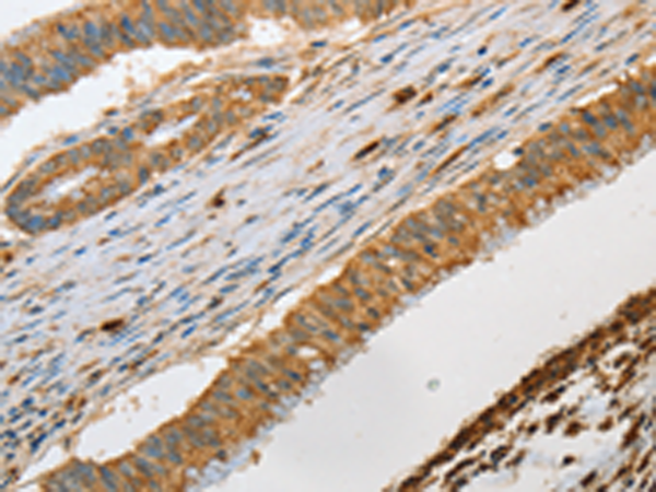 Rabbit Polyclonal Antibody to GZMB
