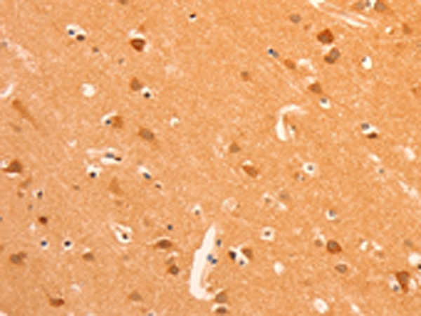Rabbit Polyclonal Antibody to GRM3