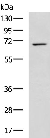 Rabbit Polyclonal Antibody to GRK4