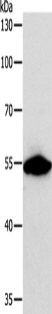 Rabbit Polyclonal Antibody to CALR