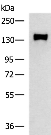 Rabbit Polyclonal Antibody to OGA
