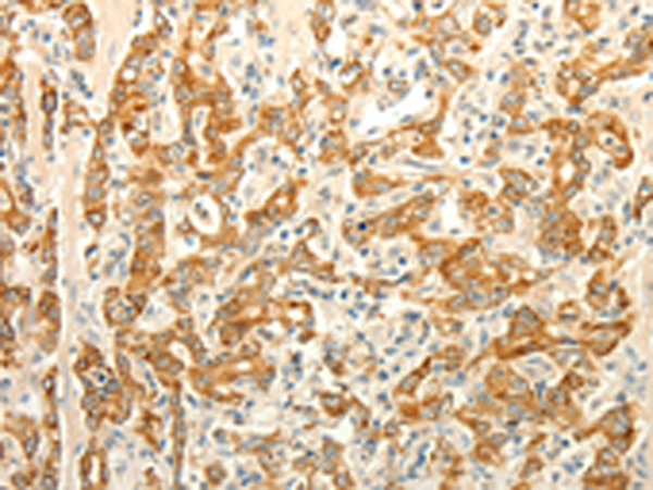 Rabbit Polyclonal Antibody to ERG