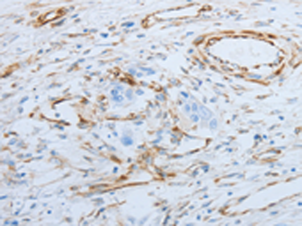 Rabbit Polyclonal Antibody to SPINT1