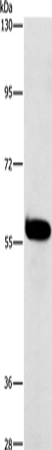 Rabbit Polyclonal Antibody to HCK