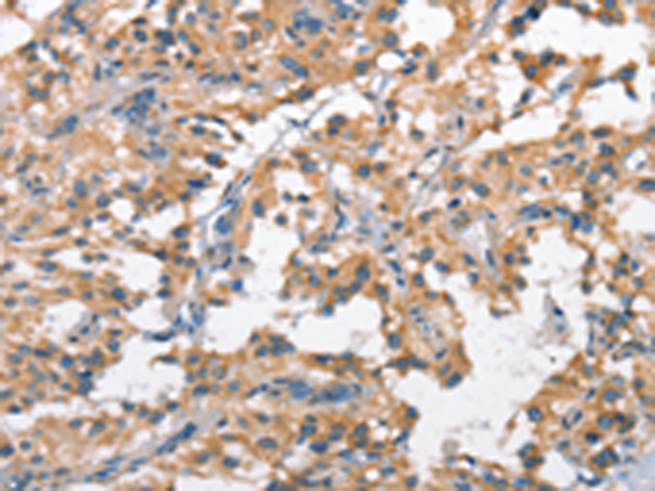 Rabbit Polyclonal Antibody to SCARB1