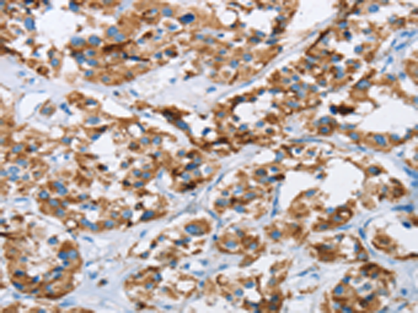 Rabbit Polyclonal Antibody to HINT2