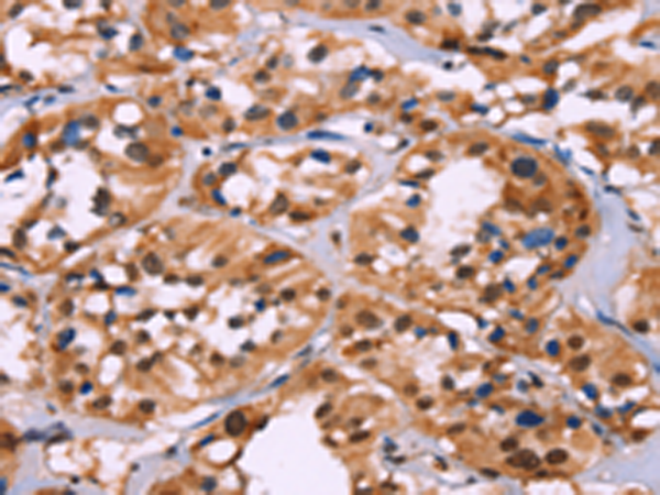 Rabbit Polyclonal Antibody to H1-2
