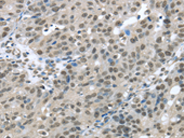 Rabbit Polyclonal Antibody to HDAC1