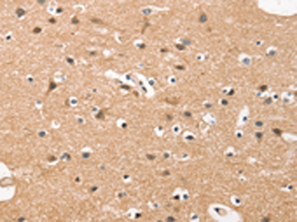 Rabbit Polyclonal Antibody to HDAC8