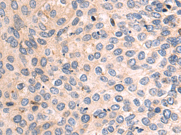 Rabbit Polyclonal Antibody to HMOX1