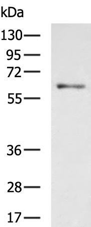 Rabbit Polyclonal Antibody to HPSE