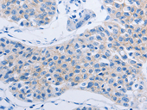Rabbit Polyclonal Antibody to HOXA6