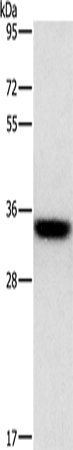 Rabbit Polyclonal Antibody to HOXB13