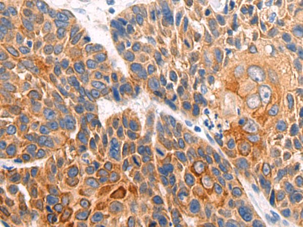 Rabbit Polyclonal Antibody to HOXB1