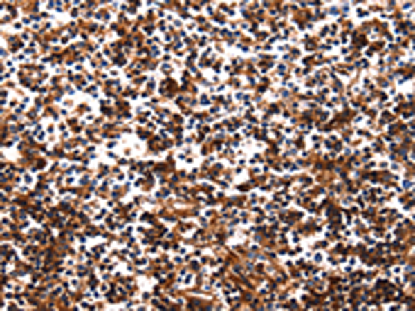Rabbit Polyclonal Antibody to HP