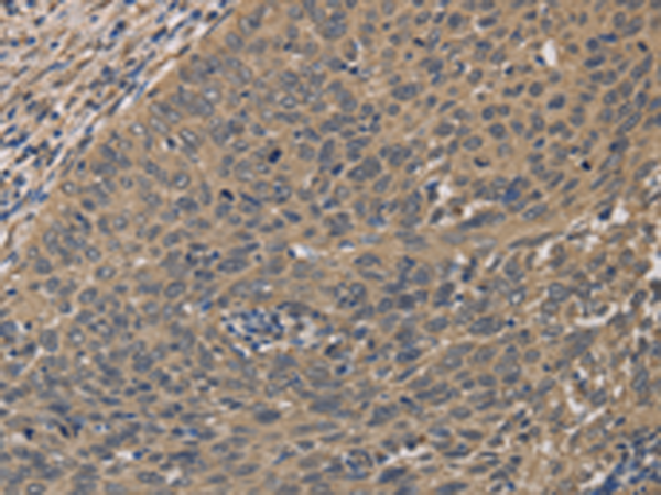 Rabbit Polyclonal Antibody to HSF1