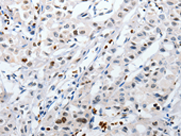 Rabbit Polyclonal Antibody to HSPA1A