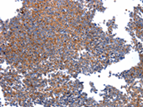 Rabbit Polyclonal Antibody to HSPD1