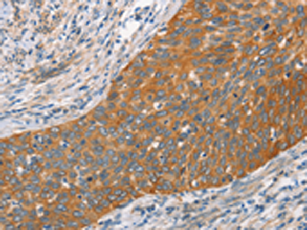 Rabbit Polyclonal Antibody to HSPB8