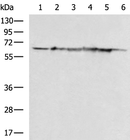 Rabbit Polyclonal Antibody to HSPD1