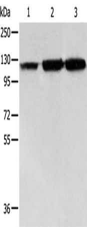 Rabbit Polyclonal Antibody to HSPH1