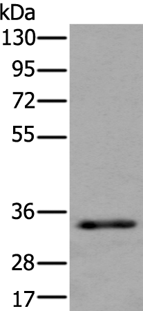 Rabbit Polyclonal Antibody to DFFA