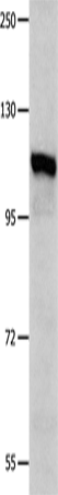 Rabbit Polyclonal Antibody to IDE