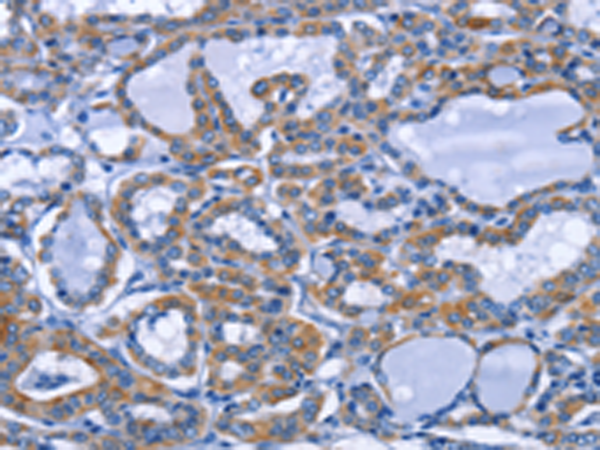 Rabbit Polyclonal Antibody to IFNG