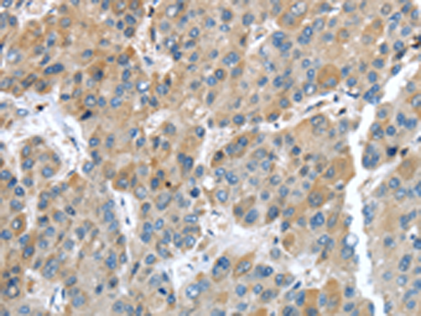 Rabbit Polyclonal Antibody to IGFBP4