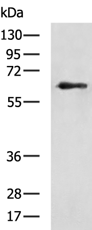 Rabbit Polyclonal Antibody to IGF2BP2