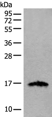 Rabbit Polyclonal Antibody to IGF2