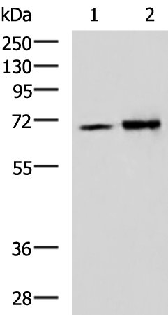 Rabbit Polyclonal Antibody to IGF2BP3