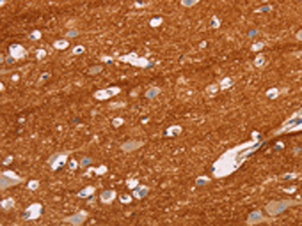 Rabbit Polyclonal Antibody to IGSF8