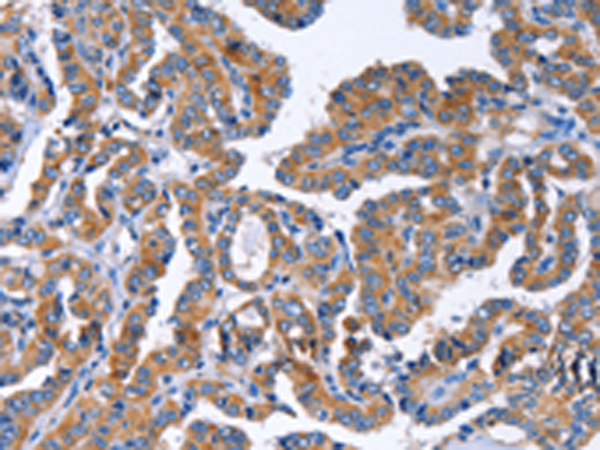 Rabbit Polyclonal Antibody to IGSF10