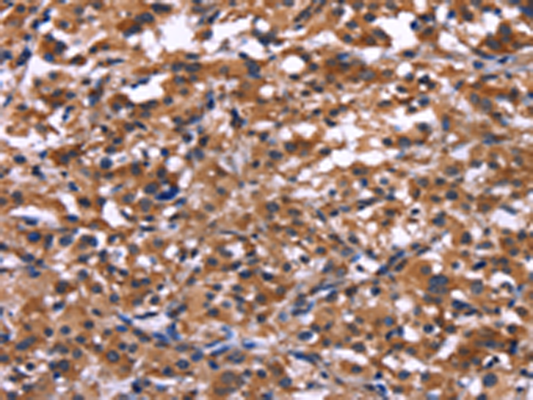 Rabbit Polyclonal Antibody to IL1A